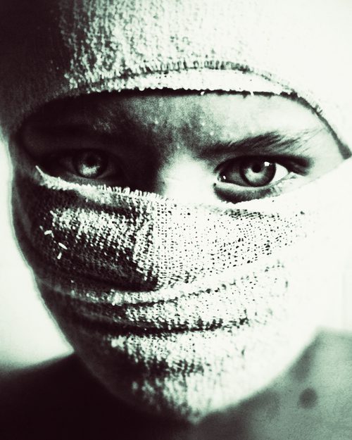 Black and white close-up portrait of a young boy with his face partially wrapped in cloth and an intense gaze